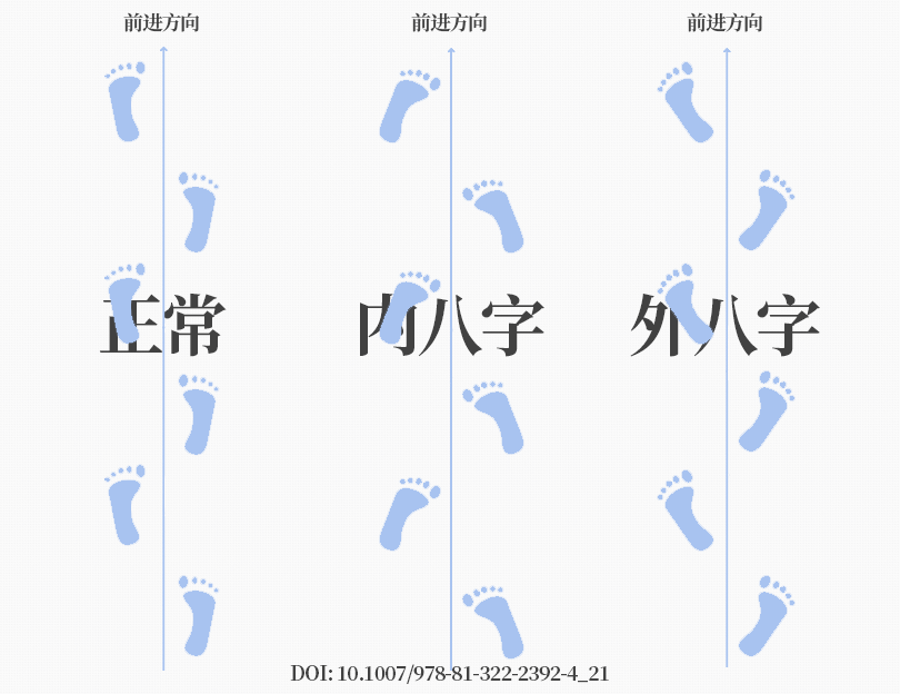 SPI足底壓力分布計(jì)量